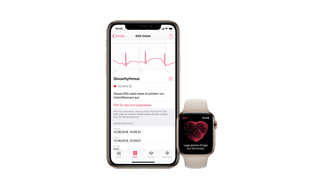 ECG app and irregular rhythm notification on Apple Watch available today across Europe and Hong Kong – Apple Newsroom