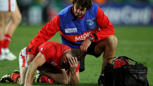 Rugby study finds brain affected in one season