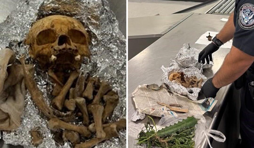 Human skull, bones in airport luggage; Passenger claims ritual use...