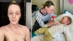 Hundreds contact BBC about mystery skin condition ‘hell’