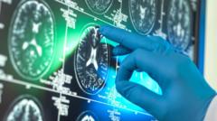 'Breakthrough' Alzheimer's drugs unlikely to benefit patients, report suggests